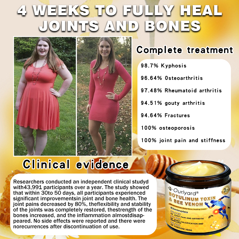 ❄️❄️🍧 Ourlyard® Botulinum Toxin & Bee Venom Pain Relief & Bone Healing Dual Action Soothing Cream (AAOS Recommended)