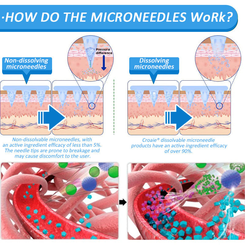 💫[7 Days to See Yourself Differently]Flysmus® 🎁 Nano Microneedle Patch with SMGT-GLP-1 & Matrixyl 3000 – Slimming, Skin Tightening, Blood Sugar Support, No Injection, 7-Day Result🌍