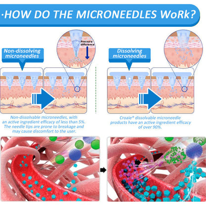 💫[7 Days to See Yourself Differently]Flysmus® 🎁 Nano Microneedle Patch with SMGT-GLP-1 & Matrixyl 3000 – Slimming, Skin Tightening, Blood Sugar Support, No Injection, 7-Day Result🌍