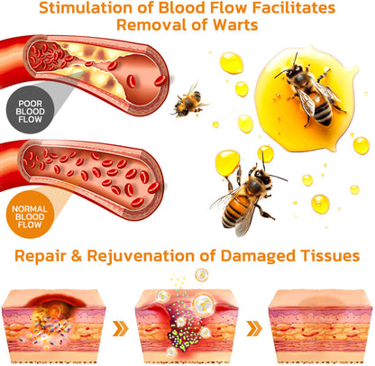 ✨Flysmus™ Bee Venom Wart and Moles Removal Cream (Last day offer, 80% discount)