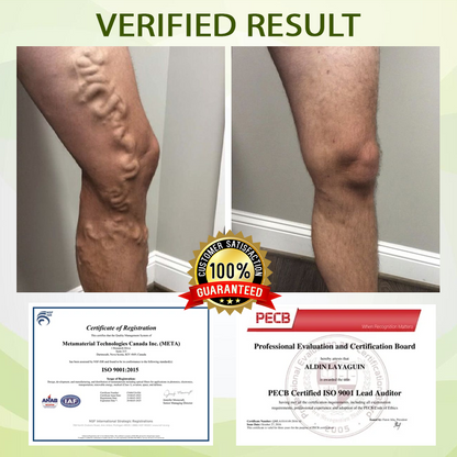 🧨Furzero™ SwellFree Lymphatic Herbal Cream
