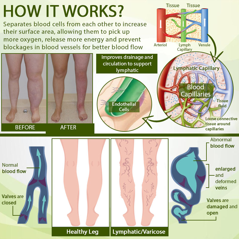 🧨Furzero™ SwellFree Lymphatic Herbal Cream
