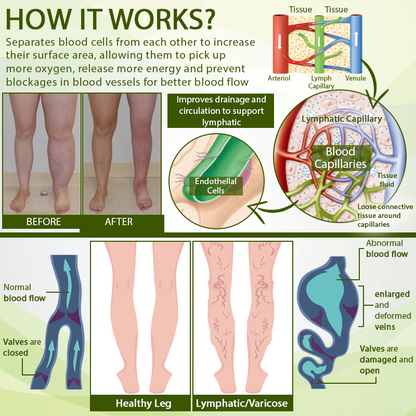 🧨Furzero™ SwellFree Lymphatic Herbal Cream