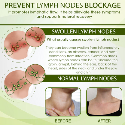 🧨Furzero™ SwellFree Lymphatic Herbal Cream