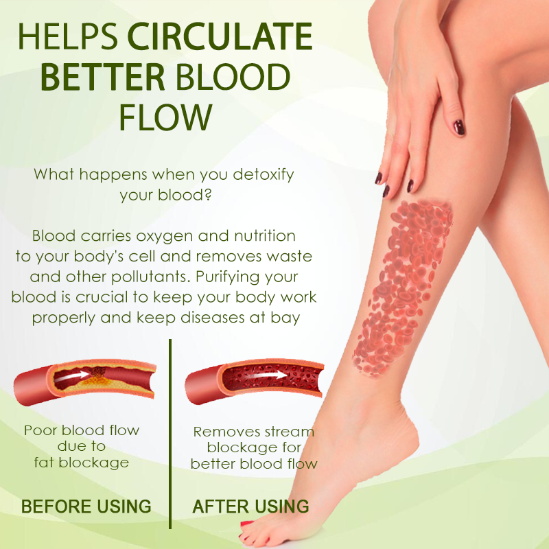 🧨Furzero™ SwellFree Lymphatic Herbal Cream