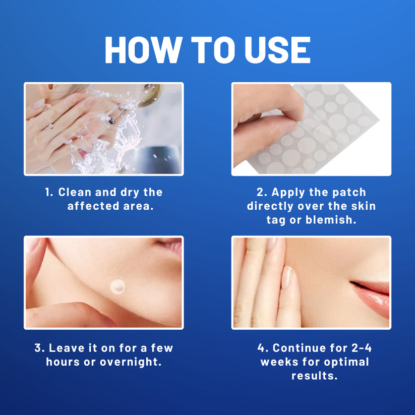 Flysmus™ Moles & Warts Removing Skin Tag Patch