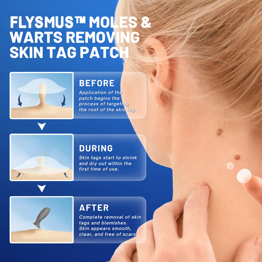 Flysmus™ Moles & Warts Removing Skin Tag Patch
