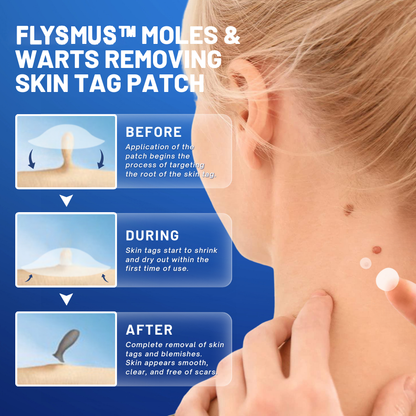 Flysmus™ Moles & Warts Removing Skin Tag Patch