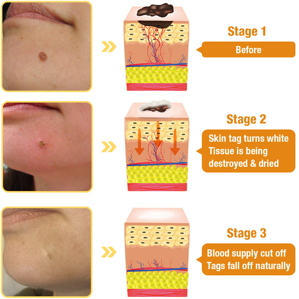 ✨𝐋𝐚𝐬𝐭 𝐃𝐚𝐲 𝐃𝐢𝐬𝐜𝐨𝐮𝐧𝐭: 87% 𝐎𝐅𝐅 🐝Flysmus™ TagRecede Bees  Treatment Spray