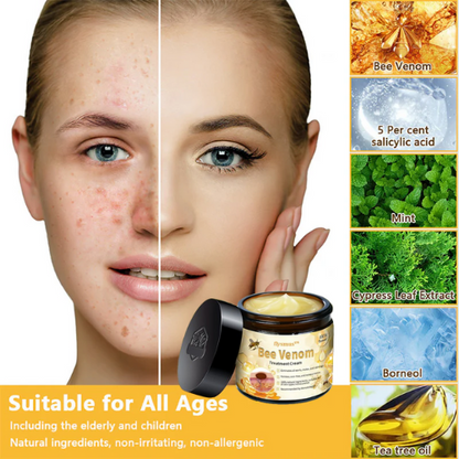🌟👍Official Store: Flysmus™ Bee Venom Skin Treatment Cream👨‍⚕️American Academy of Dermatology (AAD) Approved.