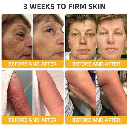 ✅ Official Store:🔥Bee Venom Retinol Skin Salve Ointment 🐝 AAD Recommended (🔥 55% Off for a Limited Time in the USA!)