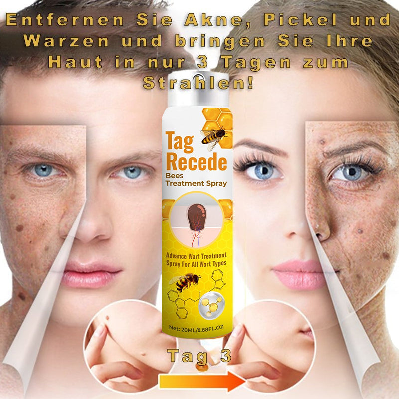 ✨𝐋𝐚𝐬𝐭 𝐃𝐚𝐲 𝐃𝐢𝐬𝐜𝐨𝐮𝐧𝐭: 87% 𝐎𝐅𝐅 🐝Flysmus™ TagRecede Bees  Treatment Spray