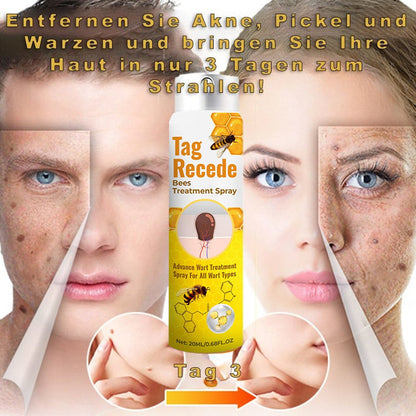 ✨𝐋𝐚𝐬𝐭 𝐃𝐚𝐲 𝐃𝐢𝐬𝐜𝐨𝐮𝐧𝐭: 87% 𝐎𝐅𝐅 🐝Flysmus™ TagRecede Bees  Treatment Spray
