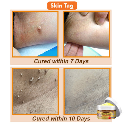 ✨🐝 flysmus™ Bee Venom Comprehensive Cream 🇺🇸 Dermatologist Recommended