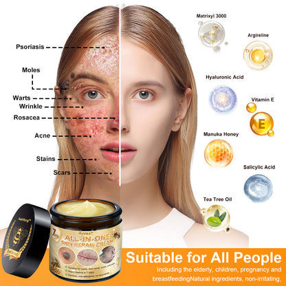 [Official Brand Store] ✨Flysmus™ Bee Venom All-in-One Cream USA Dermatologist Approved (👩‍⚕️FDA Recommended)