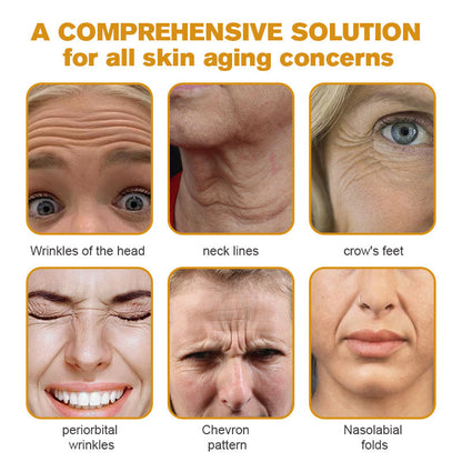 (🥳Made and Shipped from USA✅) Furzero™ Botox Bee Venom Wrinkle Removal Cream- LAST DAY 70% OFF