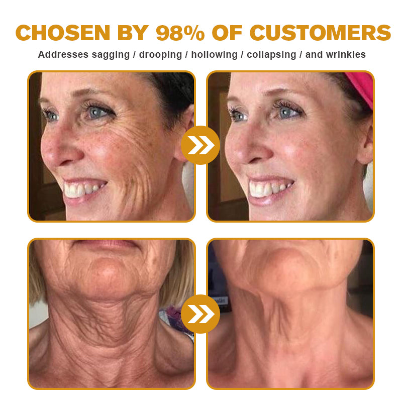 (🥳Made and Shipped from USA✅) Furzero™ Botox Bee Venom Wrinkle Removal Cream- LAST DAY 70% OFF