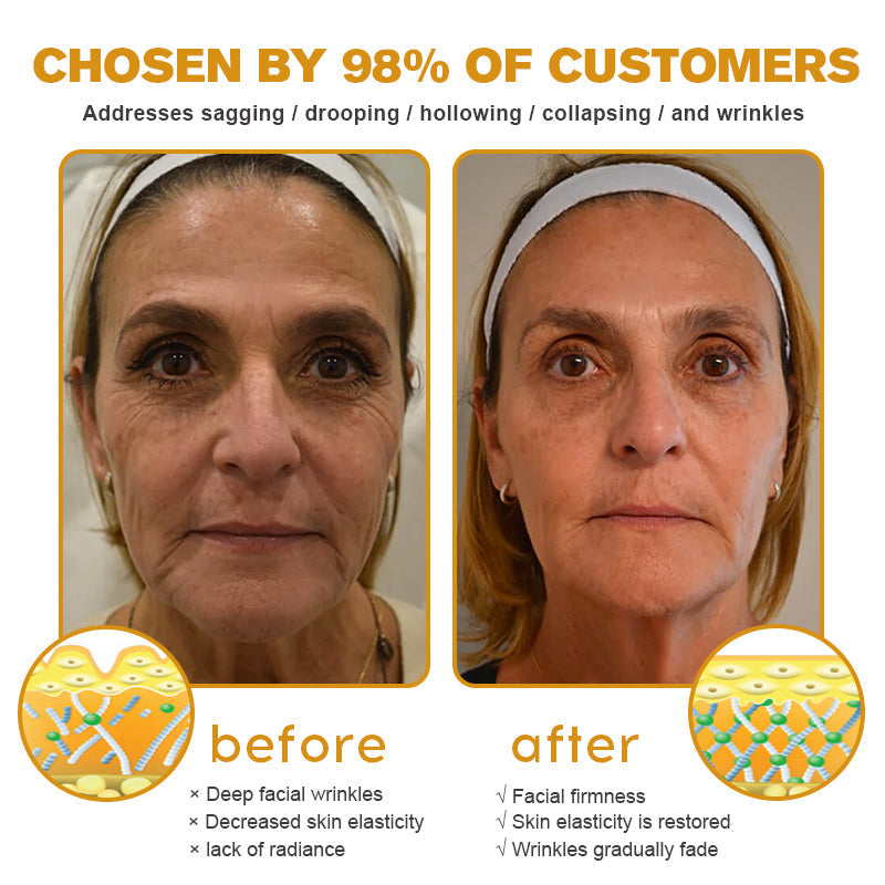 (⛰️Made and Shipped from USA✅) Furzero™ Botox Bee Venom Wrinkle Removal Cream- LAST DAY 70% OFF