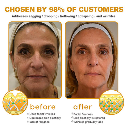 (🥳Made and Shipped from USA✅) Furzero™ Botox Bee Venom Wrinkle Removal Cream- LAST DAY 70% OFF