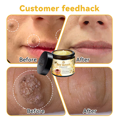🌟👍Official Store: Flysmus™ Bee Venom Skin Treatment Cream👨‍⚕️American Academy of Dermatology (AAD) Approved.