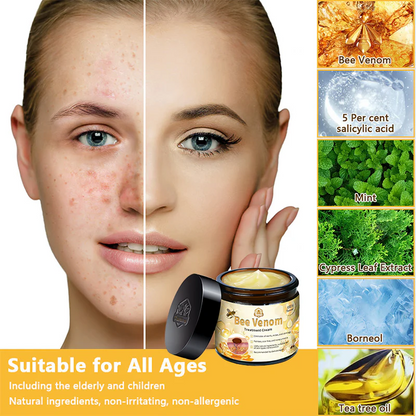 ✨✨Turonu™ Bee Venom Skin Treatment Cream（𝐴𝐴𝐷 𝑅𝑒𝑐𝑜𝑚𝑚𝑒𝑛𝑑𝑒𝑑）