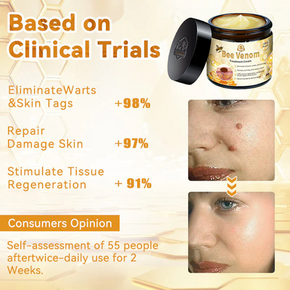 ✨✨Turonu™ Bee Venom Skin Treatment Cream（𝐴𝐴𝐷 𝑅𝑒𝑐𝑜𝑚𝑚𝑒𝑛𝑑𝑒𝑑）
