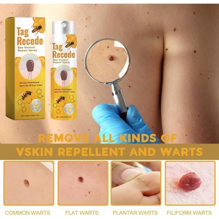 ✨𝐋𝐚𝐬𝐭 𝐃𝐚𝐲 𝐃𝐢𝐬𝐜𝐨𝐮𝐧𝐭: 87% 𝐎𝐅𝐅 🐝Flysmus™ TagRecede Bees  Treatment Spray